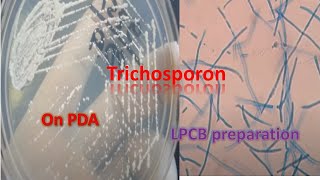 Trichosporon on SDA and LPCB preparation under the microscope [upl. by Kilroy356]