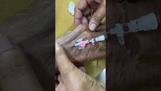 IV cannula insertiondoctornursingmotivationshortvideoviralvideo [upl. by Devad]