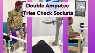 Getting My Prosthetic Check Sockets Fitted as a Double Amputee [upl. by Anirdna]