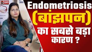 Endometriosis Symptoms Causes and Natural Treatment  Dr Chanchal Sharma [upl. by Pernell836]