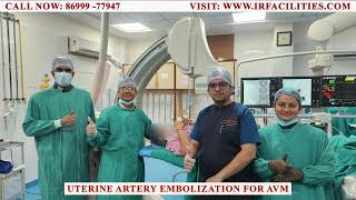 Uterine Artery Embolization for AVM  IRFACILITIES [upl. by Rebba]