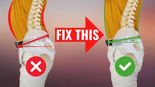 FIX Anterior Pelvic Tilt in 100 Seconds for PERFECT Posture [upl. by Ivz]