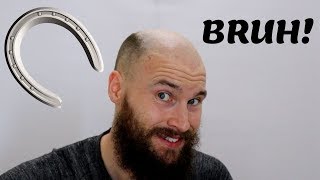 2 YEARS OF BALDING IN 2 MINUTES  Going Bald Fast Horse shoe [upl. by Anerom]