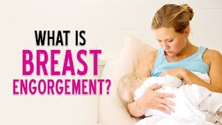 What is Breast Engorgement  DrPankaj Parekh  Dr Priti gangan  Lectsian Series  Child And You [upl. by Oliver]