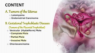 Female genital tumors II Uterus and Trophoblast شرح محاضرة [upl. by Zealand598]