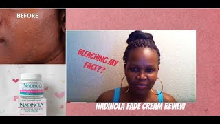 Nadinola Fade CreamExtra Strength Formula [upl. by Kilian653]