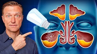 Rid Throat and Sinus Mucus with SALT [upl. by Carlin]