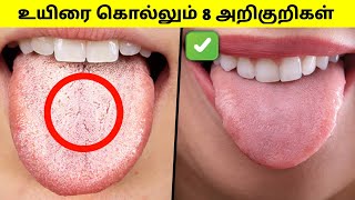 8 dangerous signs⚠️உடனே இதையெல்லாம் Check பண்ணி பாருங்கHealth awarenes mrbrother [upl. by Demmy]