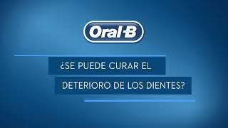 ¿Como prevenir las caries dentales [upl. by Artamas]