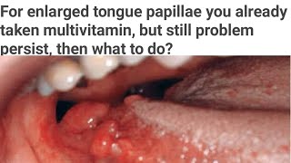 Tongue papillae enlarges you had taken multivitamin but not relieved yet then what are causes [upl. by Yadsnil422]