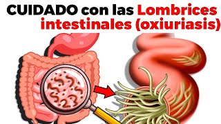 SÍNTOMAS DE LOMBRICES INTESTINALES oxiuriasis tratamiento y cómo prevenirlas [upl. by Esinaej492]