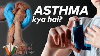 Asthma Kya Hai Aur Iska Ilaj Kaise Kiya Jata Hai  Ek Gehra Nazariya Sans Ki Bimari Par in Hindi [upl. by Tsnre71]