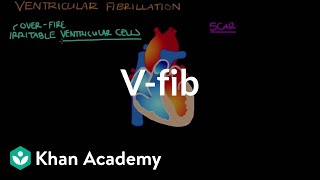 What is ventricle fibrillation Vfib  Circulatory System and Disease  NCLEXRN  Khan Academy [upl. by Levine314]