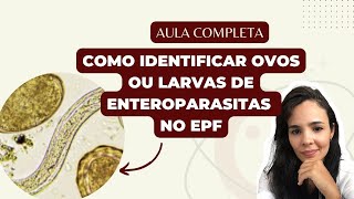 COMO IDENTIFICAR OVOS E LARVAS DE HELMINTOS NO EXAME PARASITOLÓGICO DE FEZES  AULA COMPLETA [upl. by Yecnuahc140]