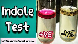 Indole test  Microbiology Microbial Biochemical test [upl. by Zoe]