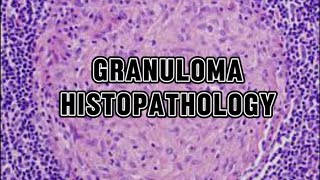 GRANULOMA  HISTOPATHOLOGY AND MORPHOLOGY [upl. by Yllime]