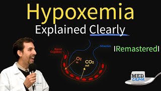 Hypoxemia  The 5 Causes amp Treatment 1 High Altitude [upl. by Charmaine]