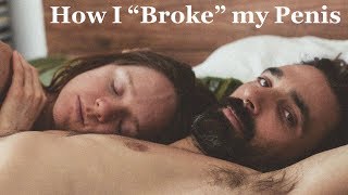 How I quotbrokequot and healed my penis  Broken blood vessel  Hematospermia [upl. by Gaal940]