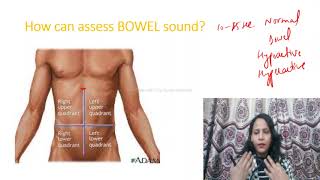 How to Assess BOWEL SOUNDProcedure of bowel Sound assessment AUSCULTATION OF ABDOMEN BORBORYGMUS [upl. by Duke571]