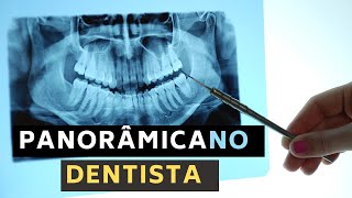 Raio X panorâmico dos dentes Porque fazer a panorâmica dentária em 5 exemplos [upl. by Trebo]