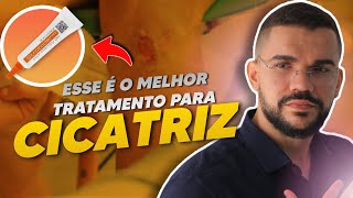 MELHOR TRATAMENTO PARA CICATRIZ QUELOIDE [upl. by Enoitna]