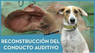 RECONSTRUCCIÓN DEL CONDUCTO AUDITIVO 👂 [upl. by Nerfe]