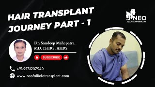 Unbelievable Hair Transformation  Hair Transplant in Bangalore  Hair Transplant Cost India  NFT [upl. by Aerdnat]