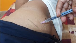 छोटे बच्चों को लगा इंजेक्शन  How to use for im injection interamuscular injection health [upl. by Ellennaj]