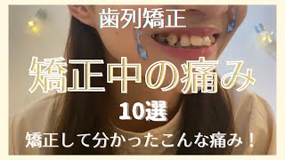 【歯列矯正】矯正の痛み10個集めてみた！ [upl. by Llennol]