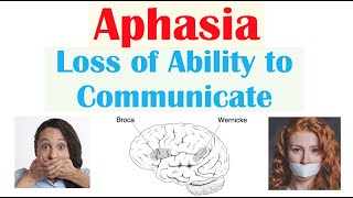 Aphasia  Types Broca’s Wernicke’s Global Causes Signs amp Symptoms Diagnosis Treatment [upl. by Burrus]