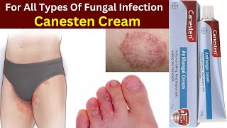 Canesten cream antifungal  Canesten clotrimazole cream how to use  canesten private parts [upl. by Vona296]