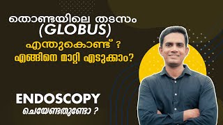 തൊണ്ടയിലെ തടസം globusഎന്തുകൊണ്ട് എങ്ങിനെ മാറ്റി എടുക്കാം endoscopy ചെയ്യെണ്ടതുണ്ടൊ [upl. by Acissehc246]