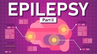 Causes of Epilepsy and How to Treat it [upl. by Seely817]