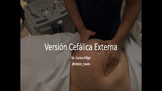 Versión Cefálica Externa  Dr Piñel [upl. by Mhoj]