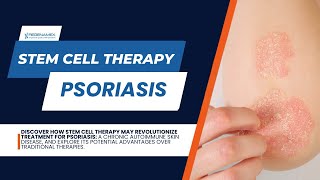 Psoriasis Sufferers Rejoice Stem Cell Therapy is Changing the Game [upl. by Bois]