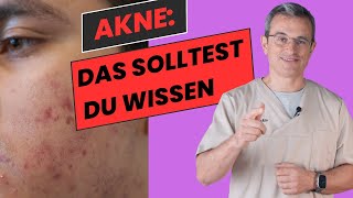 Umfassender Ratgeber zur AkneBehandlung Tipps amp Therapien von Dr Kasten akne aknebehandlung [upl. by Donoghue]