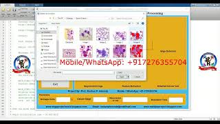 Early Stage Leukemia Blood Cancer Detection Using Matlab  Early Stage Leukemia Classification [upl. by Franciska]