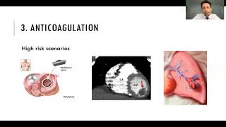 Dr Dar Dowlatshahi  Restarting Antithrombotics in ICH [upl. by Sandie918]