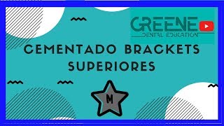 Cementado de Brackets Superiores [upl. by Nealy225]