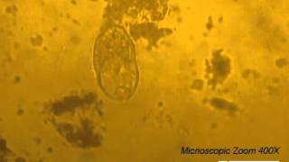 Parasitology Video Balantidium coli in TYIS33 medium  Clip 2 [upl. by Harley]