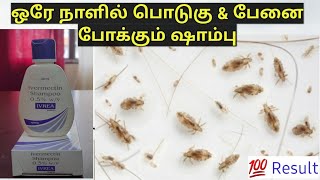 ஒரே நாளில் பேன் பிரச்சனை தீர  Ivrea Shampoo  Get Rid Of Lice amp Dandruff In Tamil haircare [upl. by Seymour]