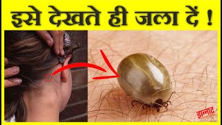 जहाँ भी ये कीड़ा दिखा इसे जला दो  Ticks that suck blood and contain viruses [upl. by Ahcsat]