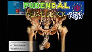 PUDENDAL NERVE BLOCK [upl. by Estelle]