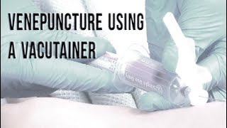 Venepuncture Using a Vacutainer [upl. by Hodosh]