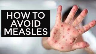 How to avoid measles [upl. by Pare]