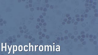 Red cells Hypochromia [upl. by Mitinger]