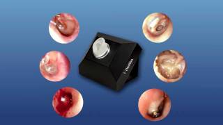 OtoSim™ Otoscopy Training amp Simulation  Intro [upl. by Ubana]