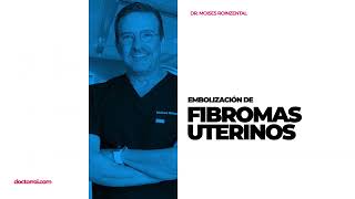 Embolización Uterina intervención mini invasiva para evitar una histerectomía por fibromas uterinos [upl. by Ayikal]