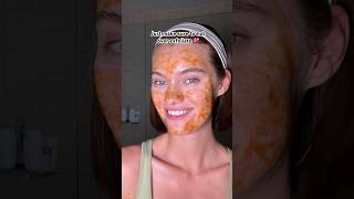 Exfoliation on ACNE prone skin💞acnetreatment acnefree skincareroutine acne [upl. by Reine]