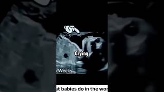 👼👼👼What Babies Do In The Womb 👼👼👼shortvideo baby [upl. by Okimik922]